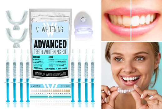 Teeth Whitening Kit | Edinburgh | Wowcher