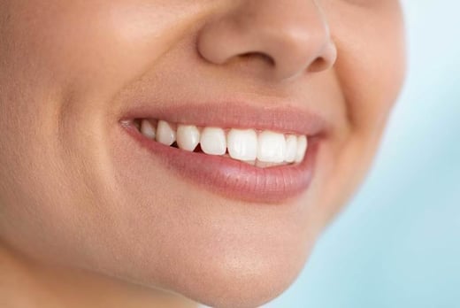 Teeth Whitening Session Voucher – Harley Street
