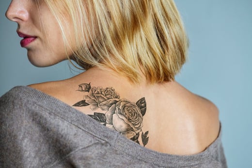 Tattoo Removal in Cornwall - Tattoo Removal Sessions - Wowcher - Cornwall -  Wowcher