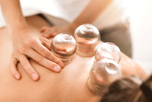 45-Min Choice of Acupuncture and Cupping Session - Kings Cross