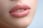 Dermal Lip Filler: 0.6ml or 1ml - Newry