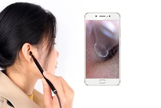 ear wax removal with camera near me