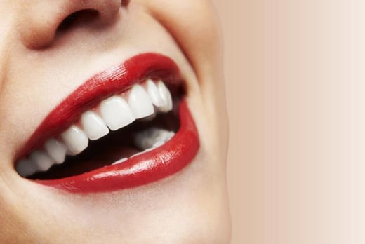 Nottingham laser teeth whitening