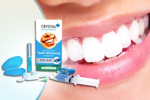 Home LED Teeth Whitening Kit | Shop | Wowcher